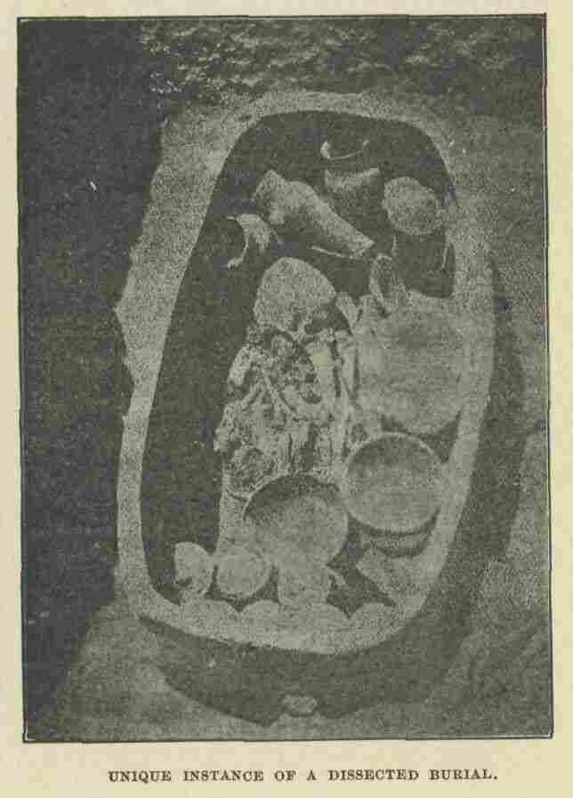 408.jpg Unique Instance of a Dissected Burial 