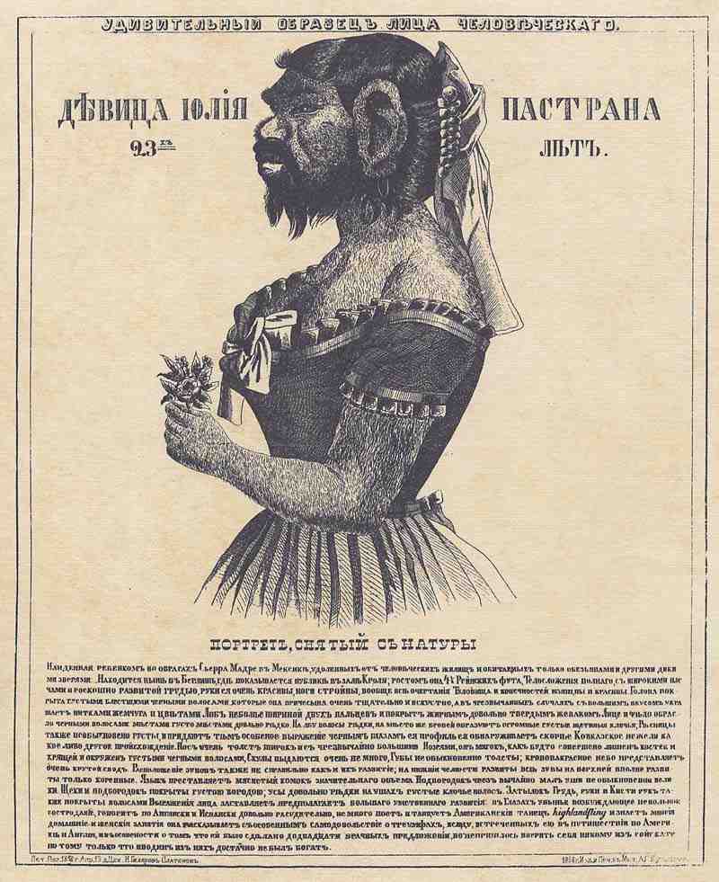 The monkey girl Julia from Mexico. Russian Lithograph 1858