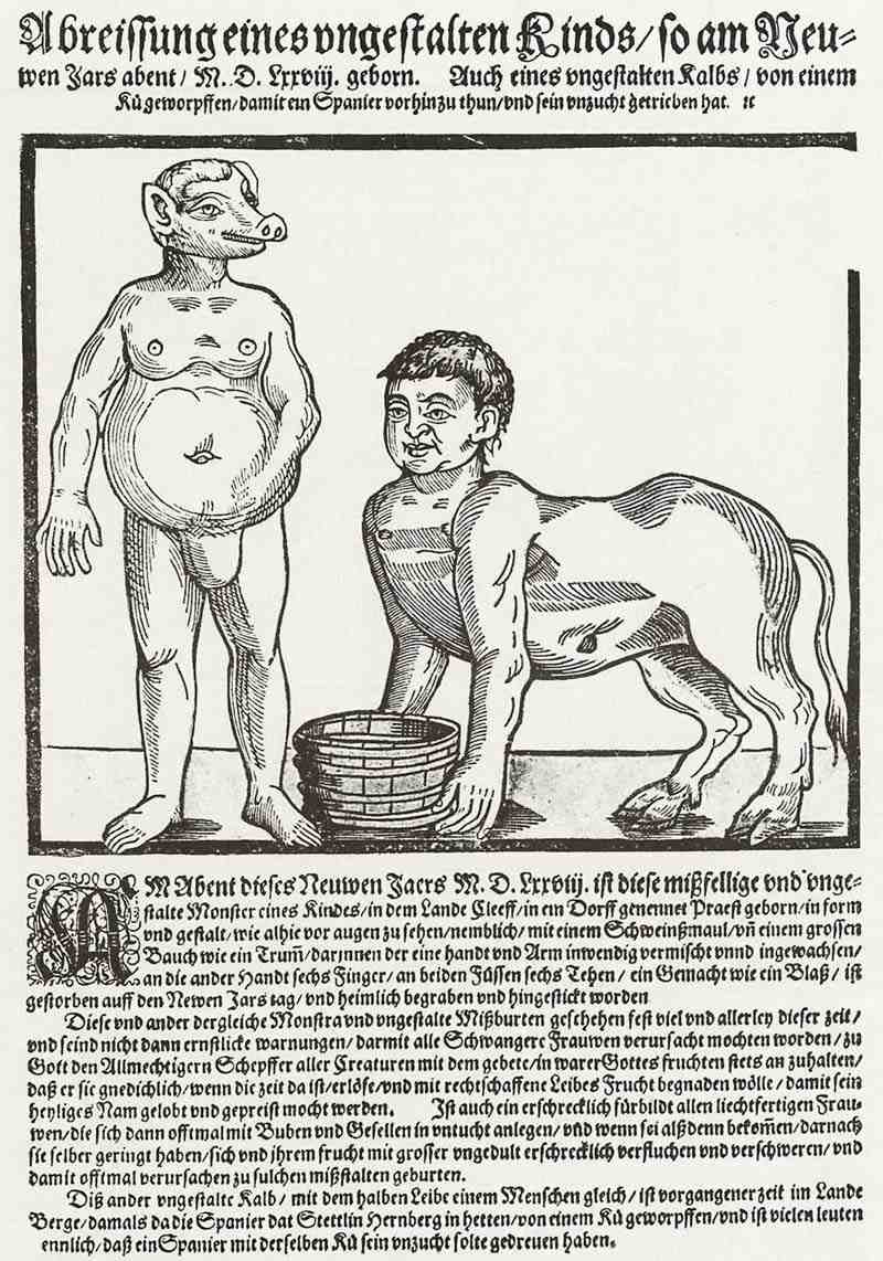 Abnormal births of two children. German master of the 2nd half of the 16th century 