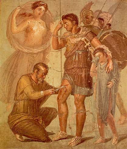 Iapyx behandelt eine Wunde von Aeneas